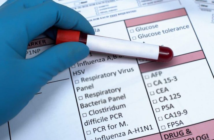 How To Read Your Wellness Blood Test Results